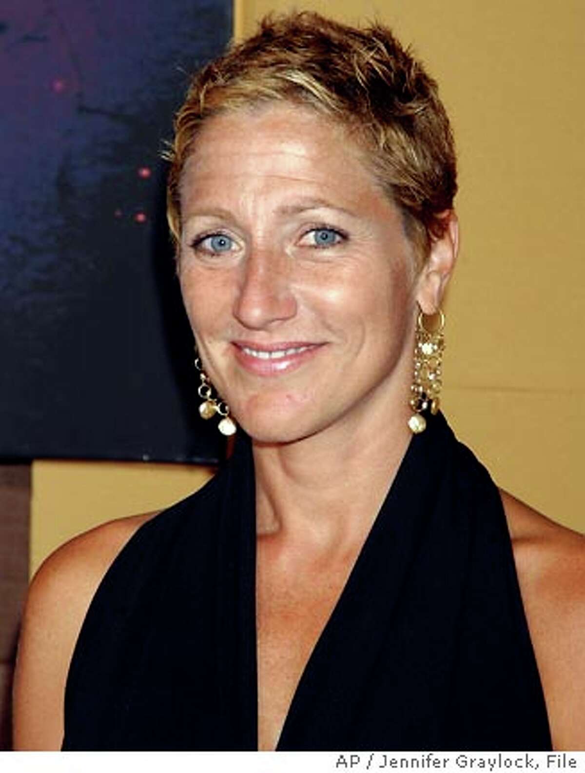 'Sopranos' star beats cancer; Nick finally speaks out about Paris; Dolly  Parton to downsize