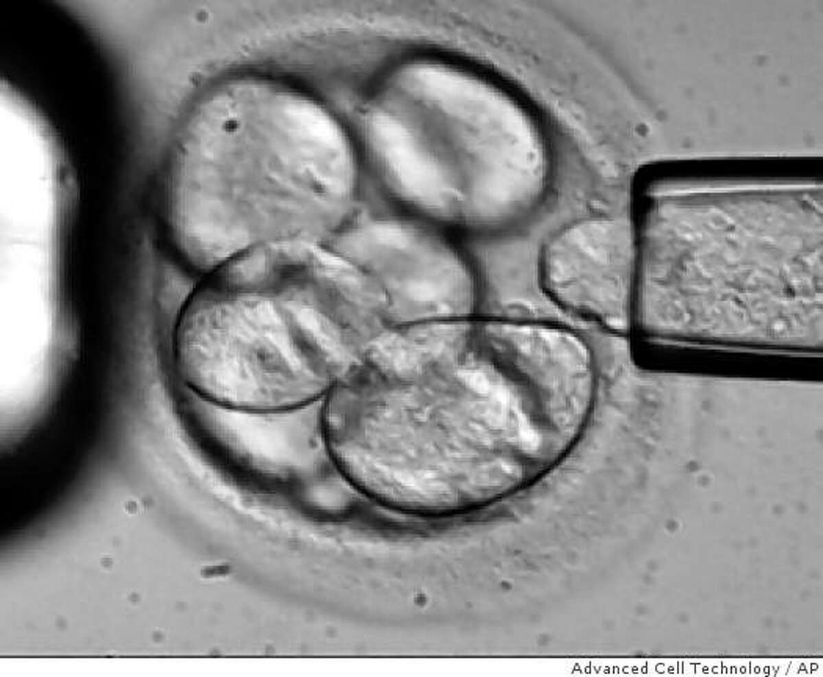 In this file photo originally made available by Advanced Cell Technology in 2006,, a single cell is removed from a human embryo to be used in generating embryonic stem cells for scientific research.
