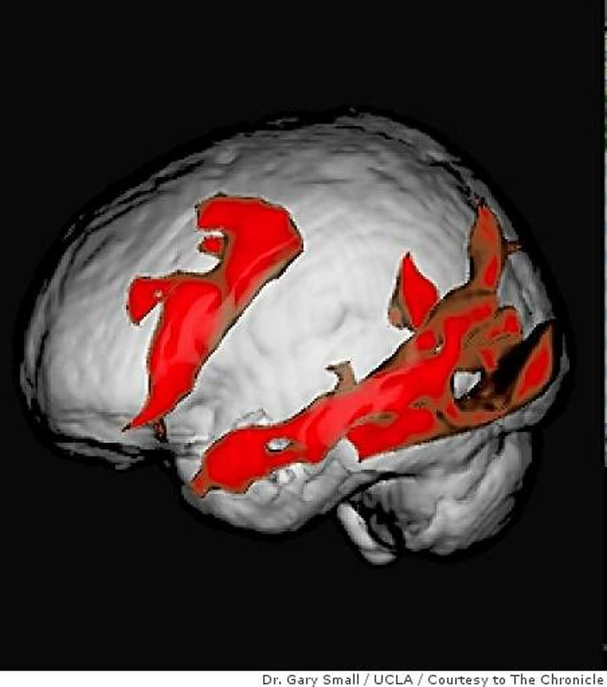 MRI image of an older brain reading book-type text on a screen. Study by Dr. Gary Small, UCLA.