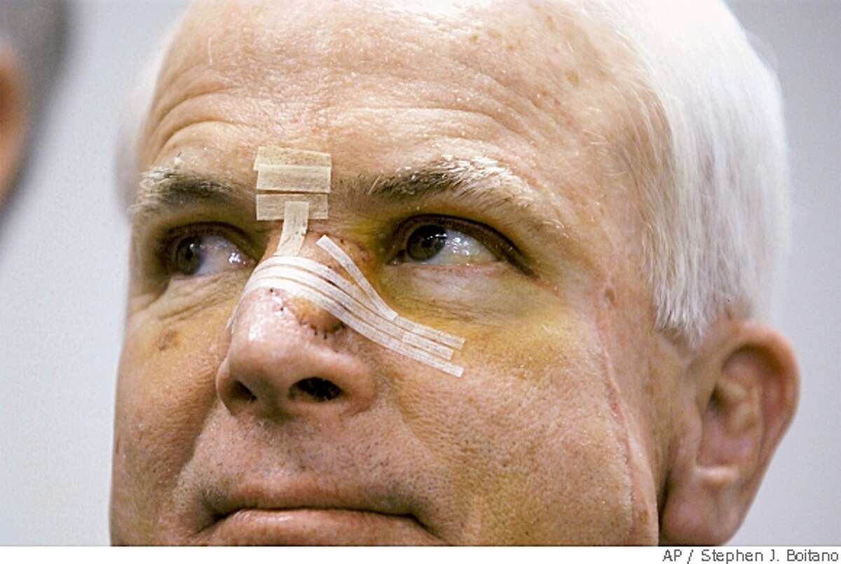 ** FILE ** In this Feb. 11, 2002 file photo, a bandaged Sen. John McCain, R-Ariz., takes part in a Washington news conference. Three-time melanoma survivor McCain appears cancer-free, has a strong heart and is in otherwise general good health, according to eight years of medical records reviewed by The Associated Press. (AP Photo/Stephen J. Boitano, File)