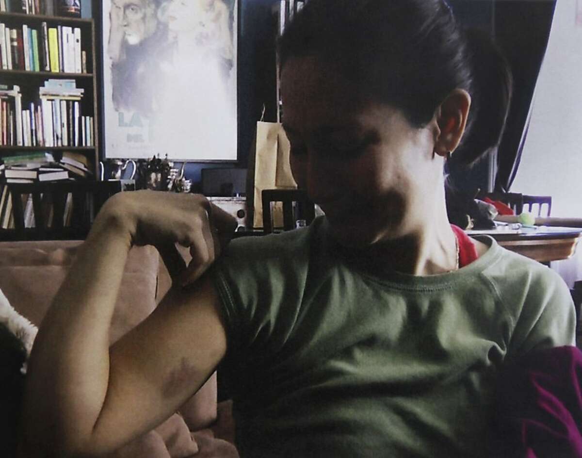 The San Francisco District Attorney's office released still images, on Friday, Feb. 24, 2012, from a video shot by neighbor Ivory Madison of Eliana Lopez displaying a bruise allegedly sustained after a heated argument with Lopez's husband, Sheriff Ross Mirkarimi.