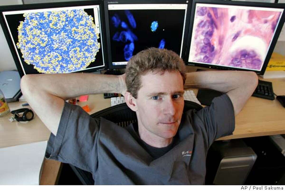 UCSF team uncovers possible link between virus and