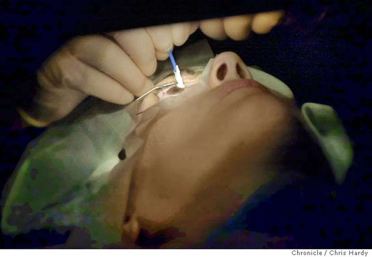 Dr. Edward Manche repairing Gena Steward's eyes. Chronicle photo by Chris Hardy