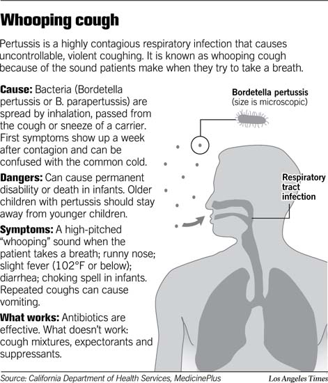 What Is The Causes Of Whooping Cough