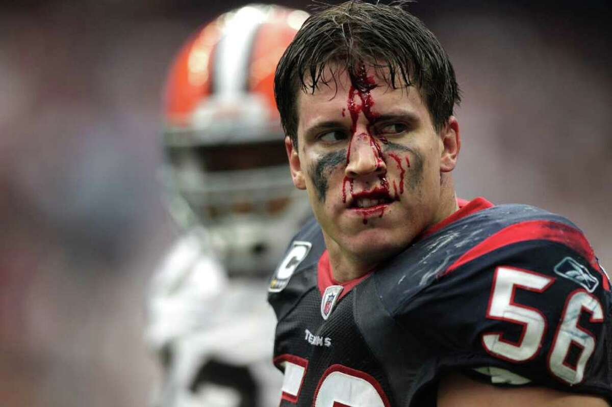 Houston Texans inside linebacker Brian Cushing (56) walks off the field with his face bloodied after an altercation with Cleveland Browns offensive guard Shawn Lauvao during the second quarter of an NFL football game at Reliant Stadium in Houston.