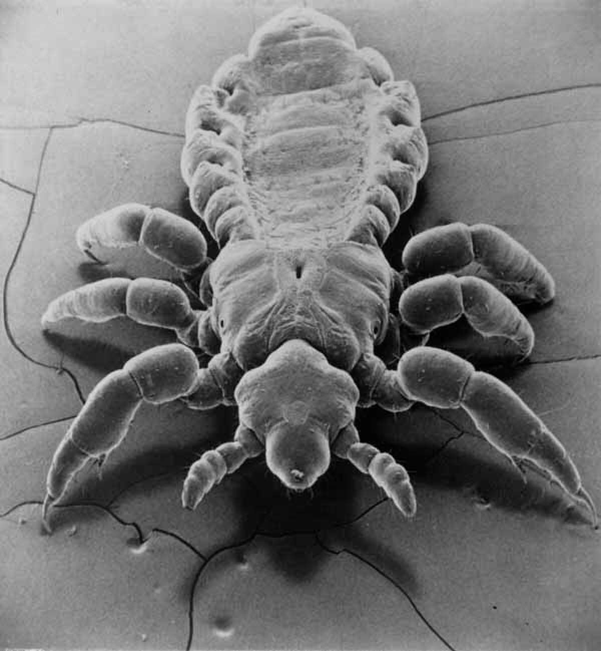 This unusual greatly magnified photograph of the human head louse was taken with an electron microscope. T