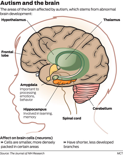 Rare gene mutations found to heighten risk of autism