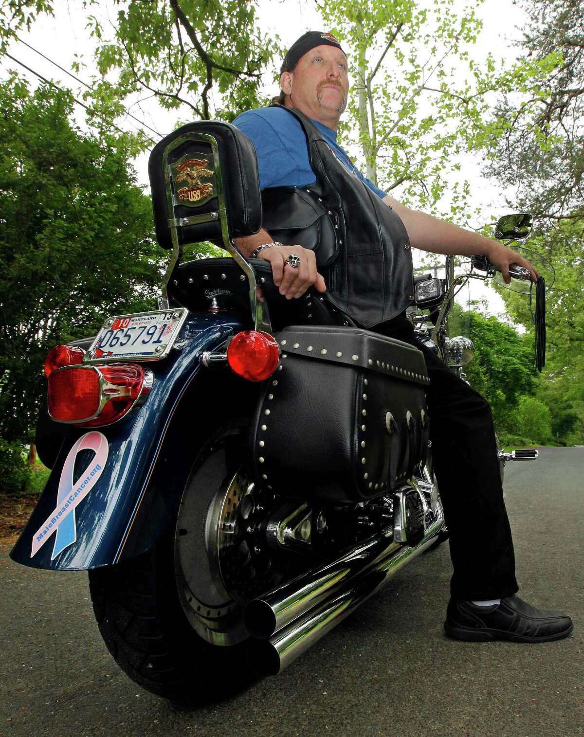 Breast cancer is rare in men, but they fare worse