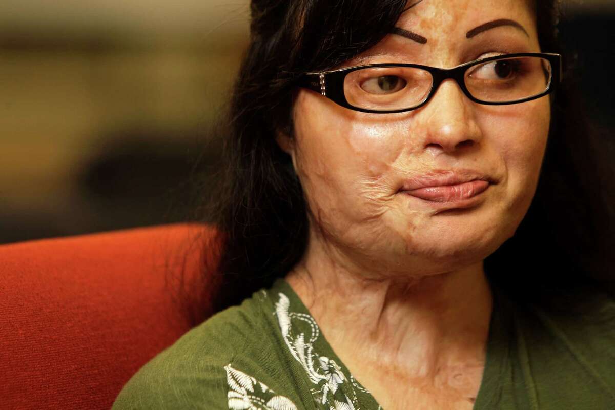 Julie Aftab could neither read nor write English when she arrived in Houston for surgery in 2004. Now she's studying accounting at UH-Clear Lake, and considers the scars from the brutal acid attack she suffered in Pakistan at age 16 "my gift from God."