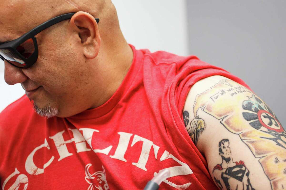 What Was I Thinking Locals Line Up For Tattoo Removal