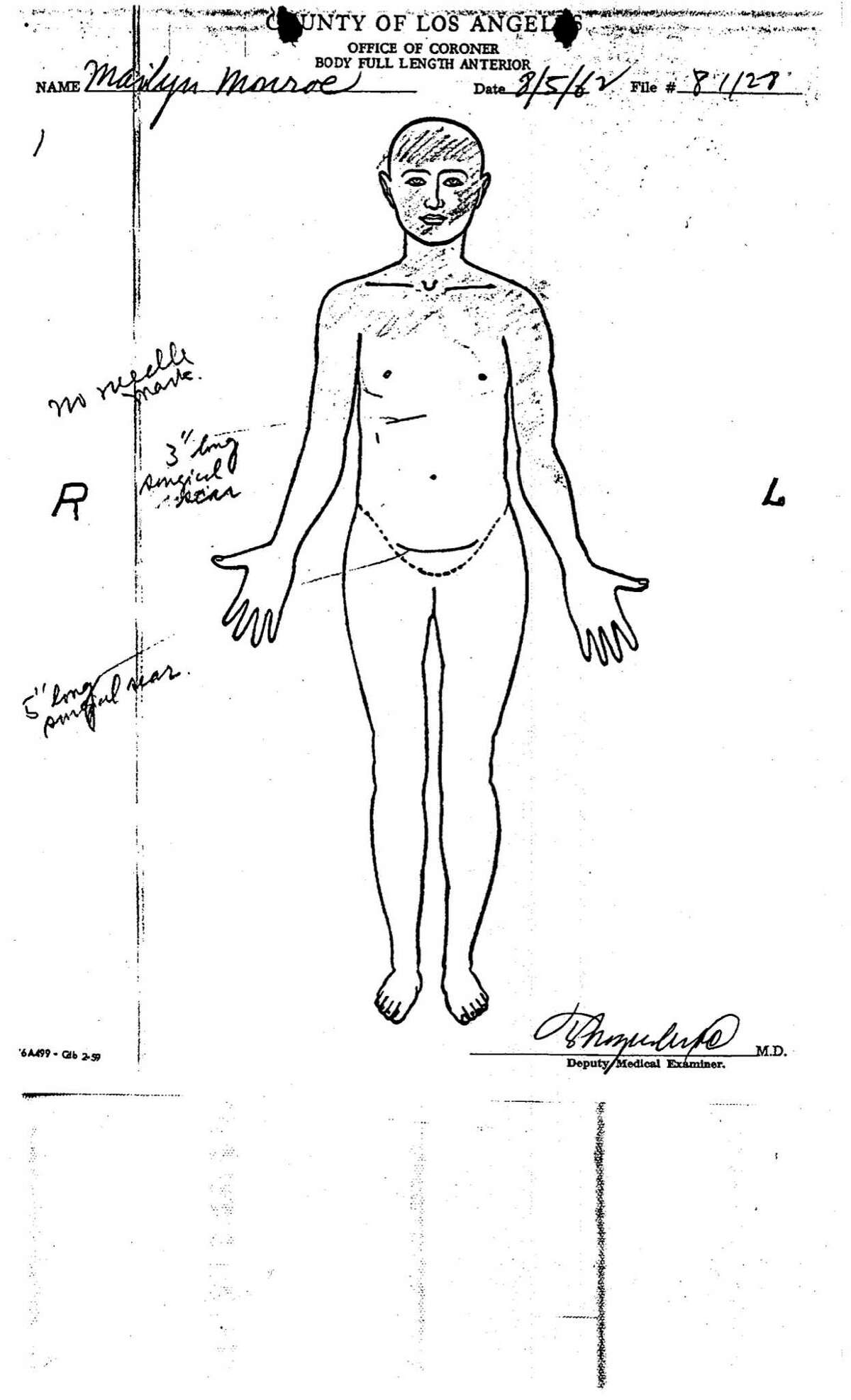 What Really Happened? Marilyn's Morgue Photos Speak