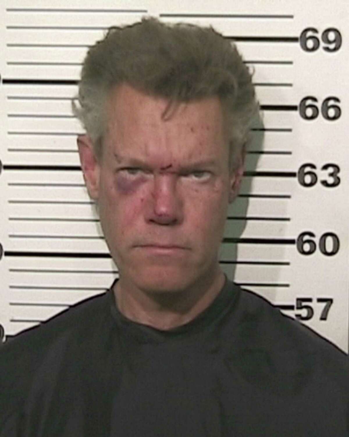 Randy Travis' booking photo shows injuries sustained in the crash.