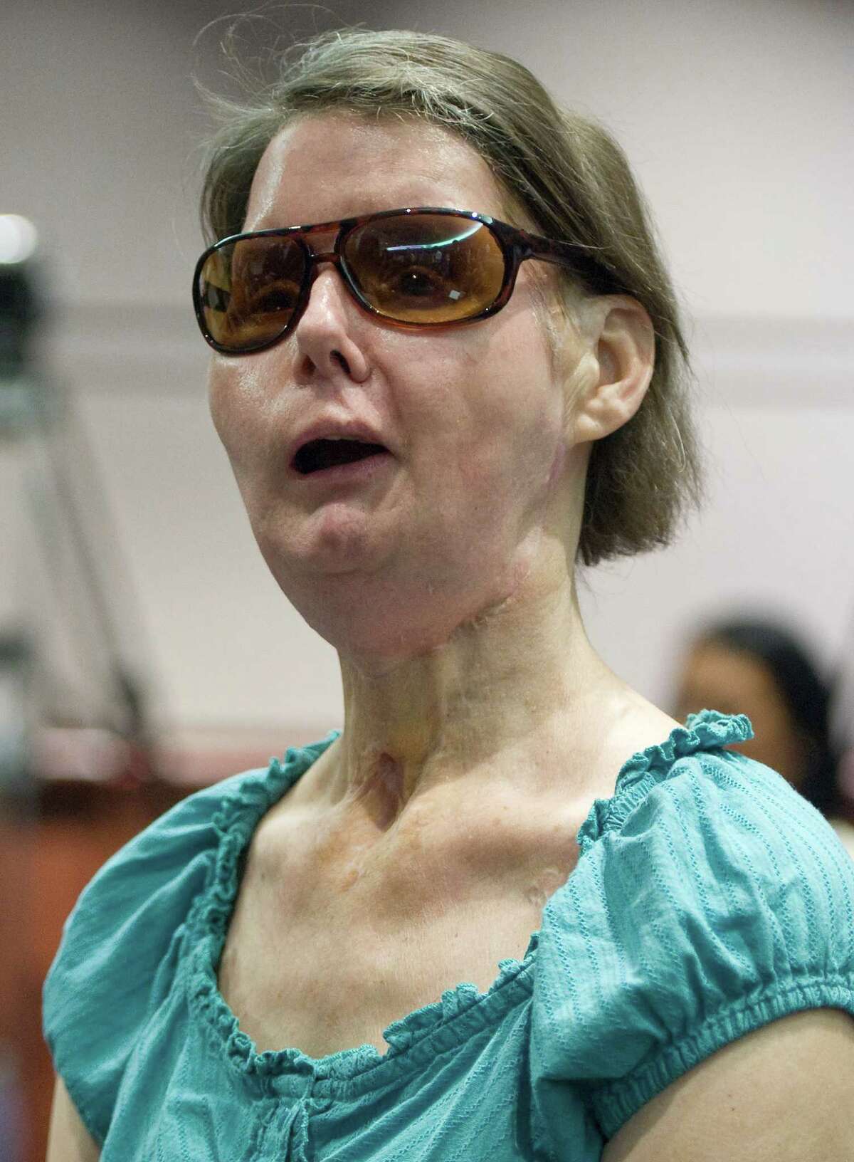 The Chilling Charla Nash Attack: Unseen Images Revealed - qs5atyk