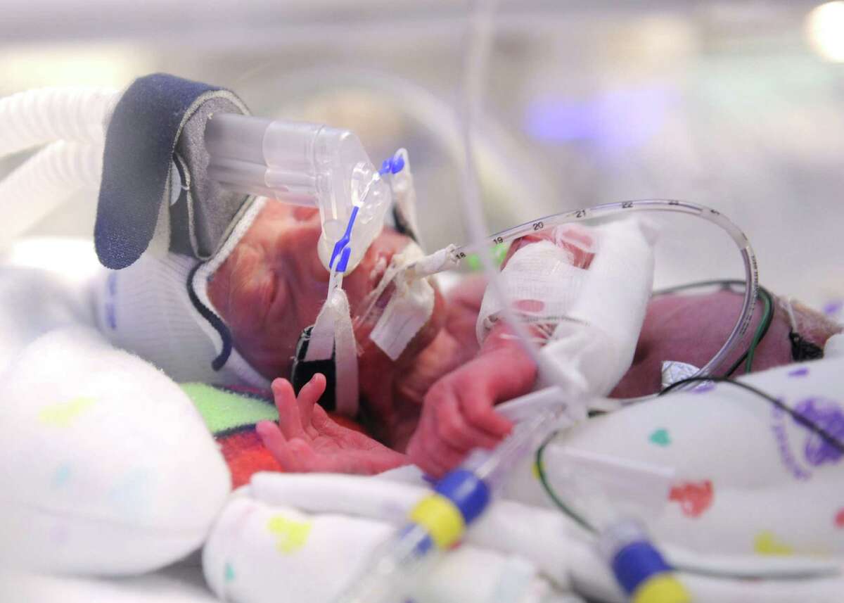 This undated photo provided by University of Texas Southwestern Medical Center shows David Jones, one of the quintuplets born to Carrie and Isaac Jones on Thursday, Aug. 9, 2012, in Dallas. All were in stable condition Monday, and are in neonatal intensive care since they were born prematurely. (AP Photo/University of Texas Southwestern Medical Center)