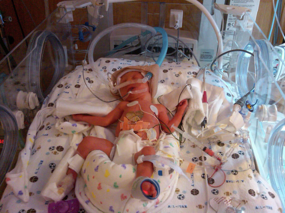 Tiniest lives saved at Danbury's NICU