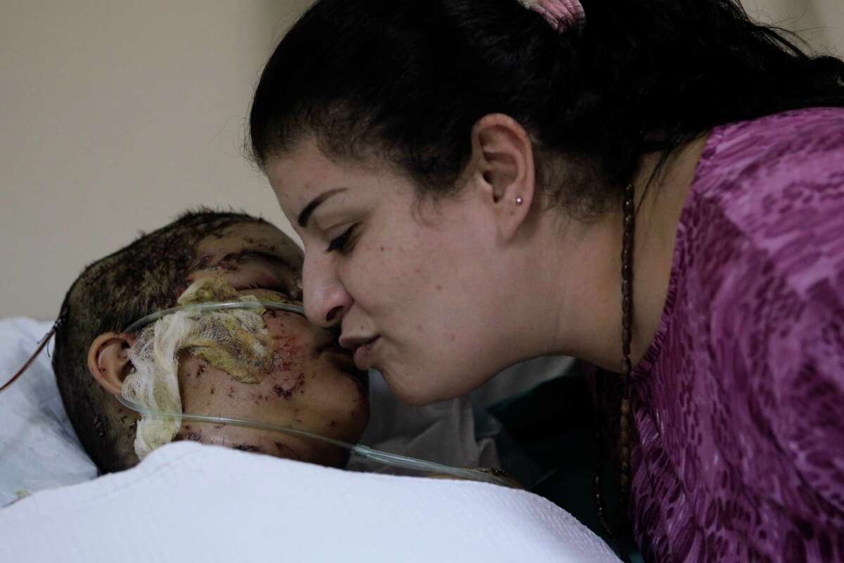 Nisrin Shedid, kisses her daughter, Jennifer Shedid, 10, on Monday in the intensive care unit of a hospital in Beirut, Lebanon. Jennifer was seriously injured by the car bomb that assassinated Brig. Gen. Wissam al-Hassan on Friday.