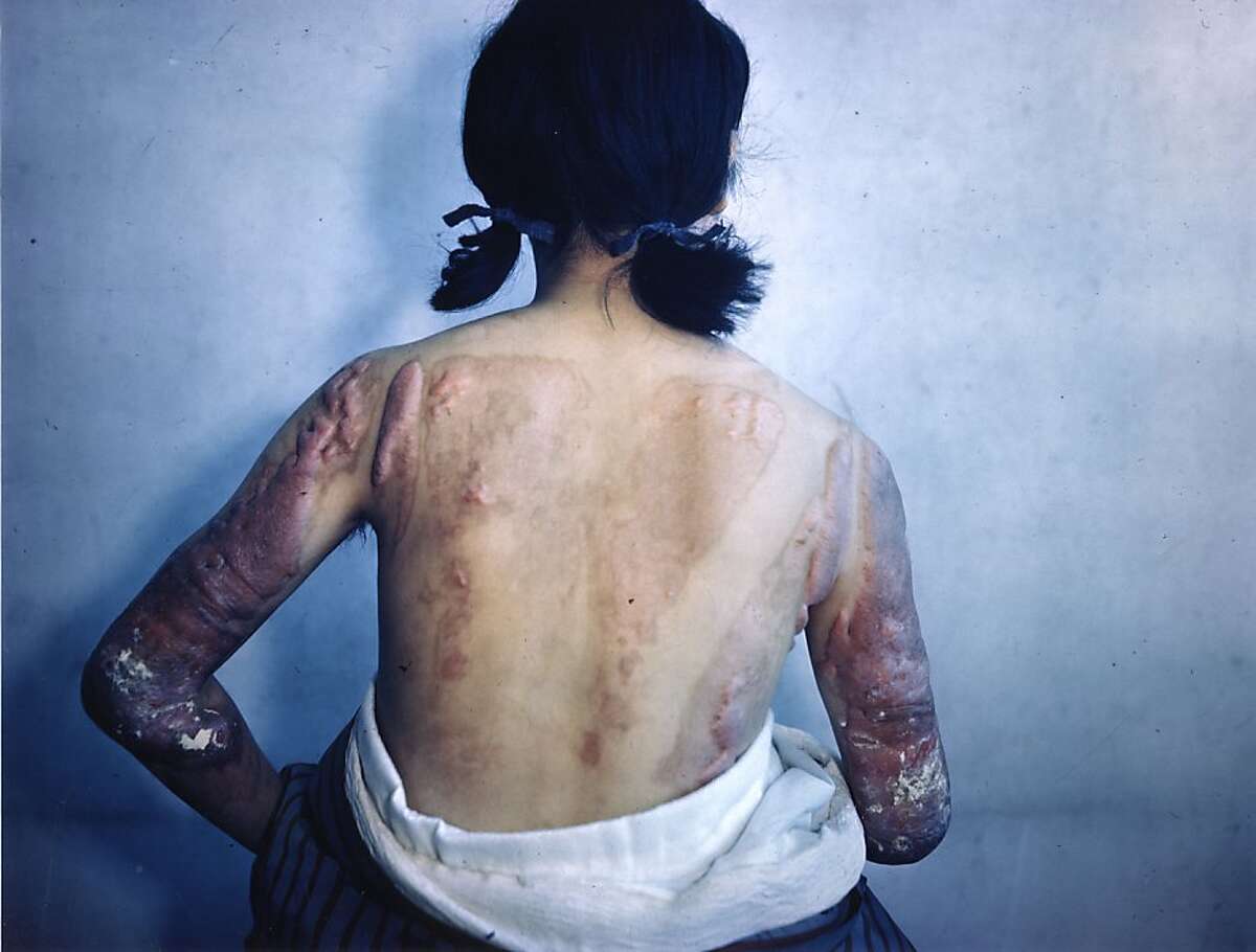 A still from the documentary series OLIVER STONE'S UNTOLD HISTORY OF THE UNITED STATES. Burned Skin