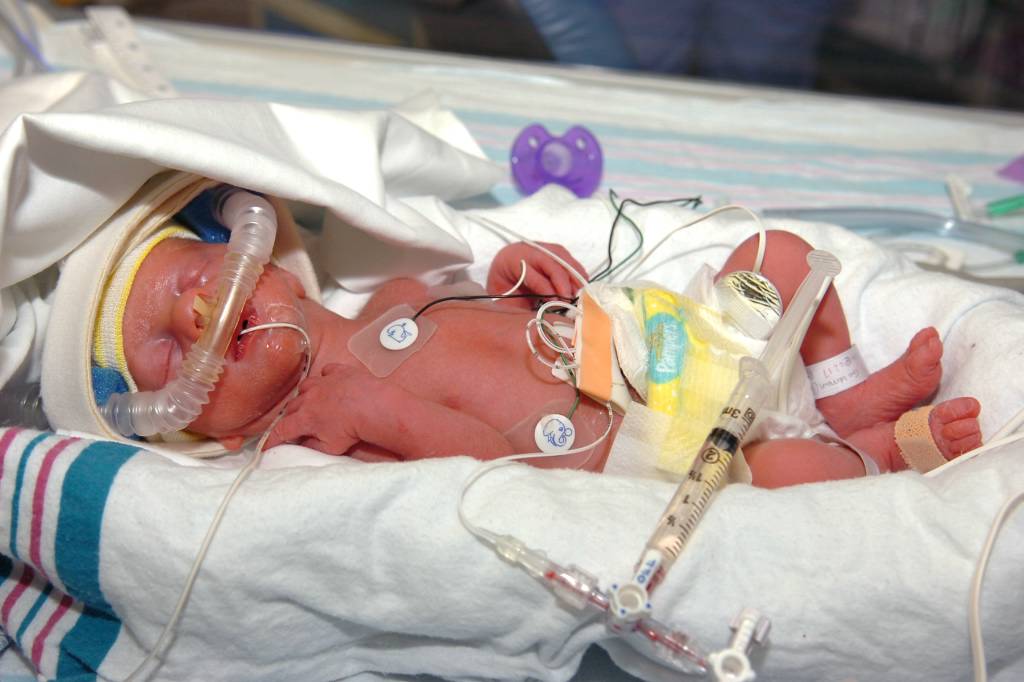 First babies of the year -- premature twins - Connecticut Post