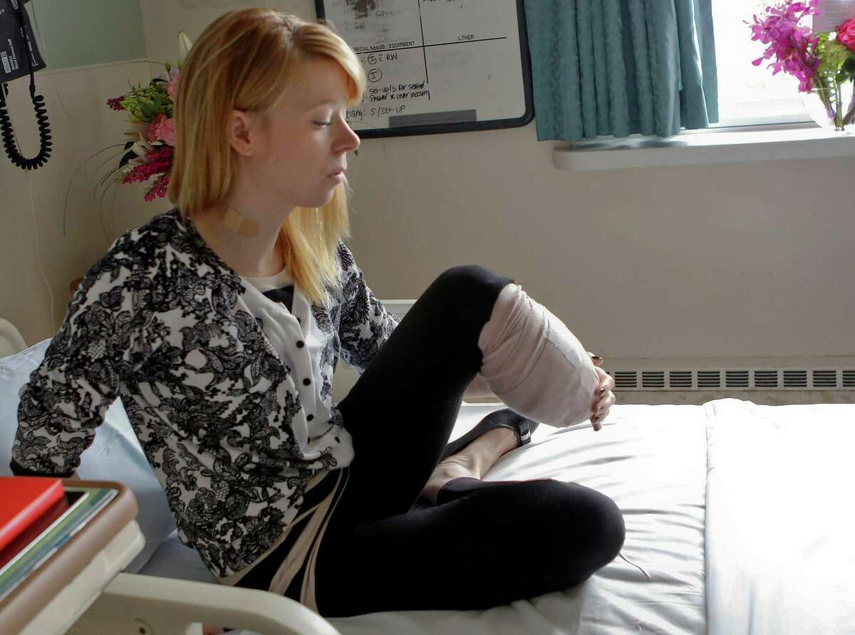 Boston Marathon victim donates prosthetic leg to amputee
