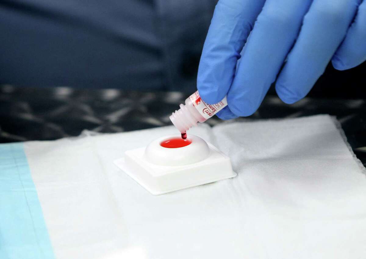 1minute HIV test to debut in S.A.