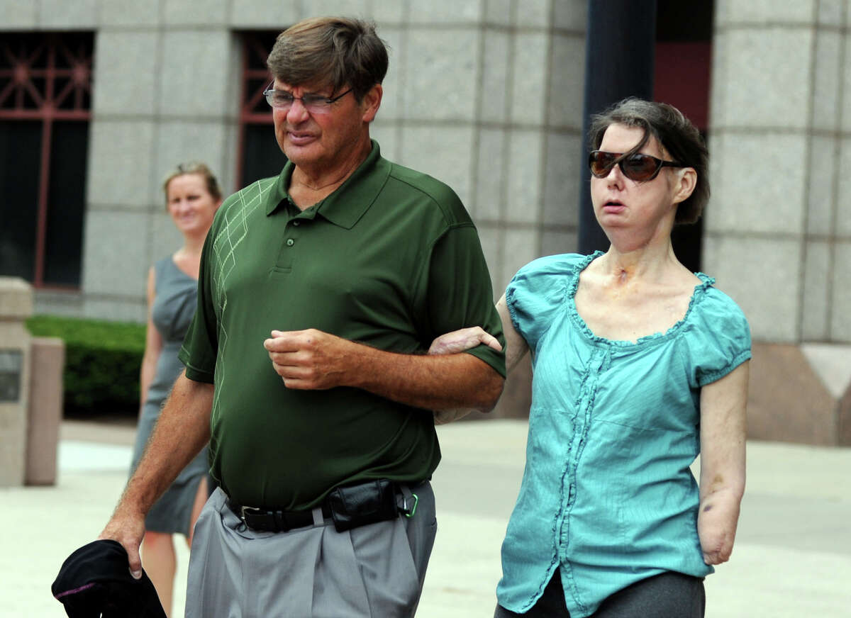 Charla Nash leaves the Legislative Office Building in Hartford, Conn., accompanied by her brother Steve Nash, following a hearing before the state Claims Commissioner Friday, August 10, 2012. Nash is seeking permission from the commissioner to sue the state for $150 million in damages from a 2009 chimpanzee attack.