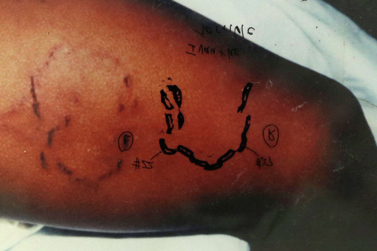 Bitemark 'science' on its way out?