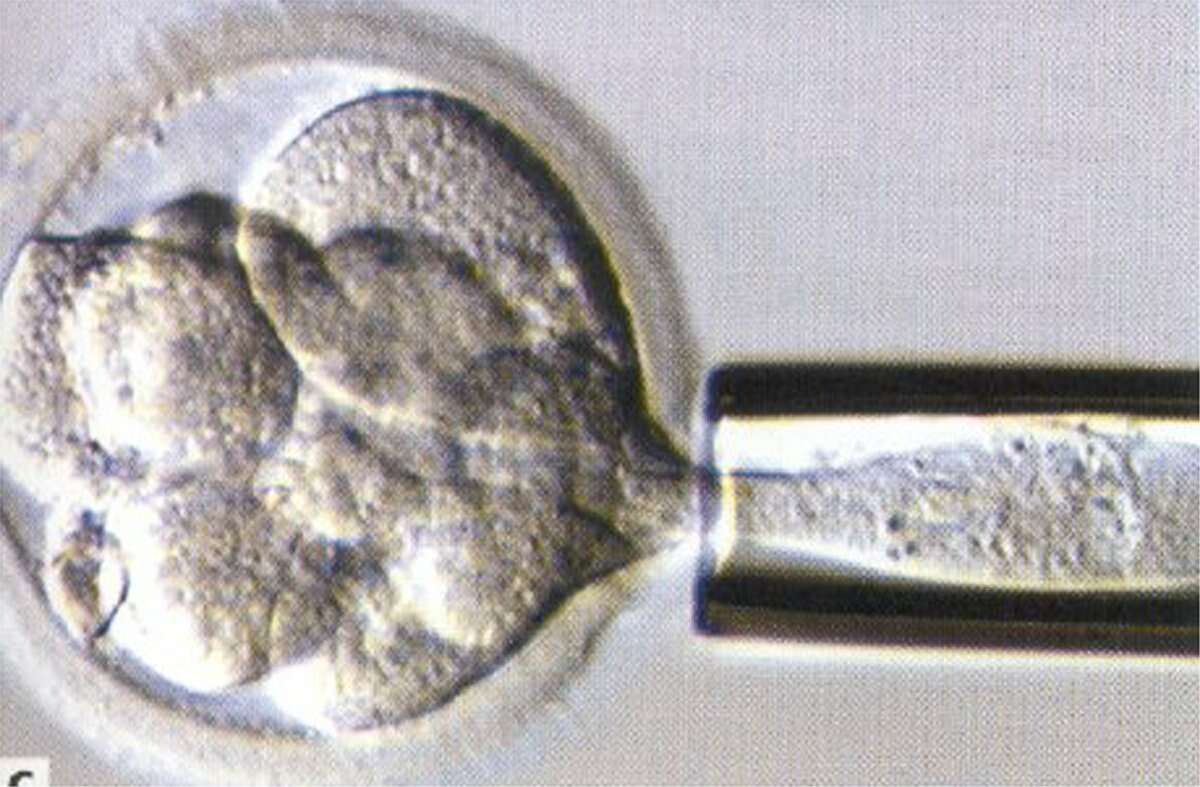KRT US NEWS STORY SLUGGED: MED-BADGENES KRT PHOTOGRAPH VIA PHILADELPHIA INQUIRER (February 11) Under a microscope, a single cell is removed for DNA analysis while an embryo grows for another day. If the DNA analysis indicates the embryo is healthy, it will be placed in the woman's uterus to implant and start a pregnancy. (smd) 2003