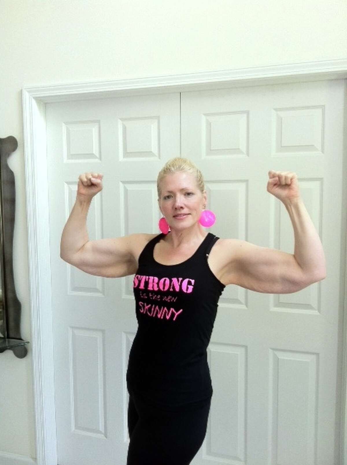 After weight loss, skin remains