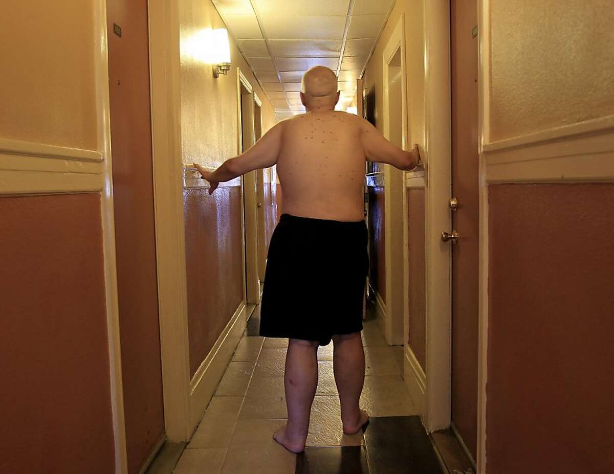 Tim Martin negotiates a hallway in the Baldwin Hotel and make his way to the restroom in the sprint of 2013. Tim Martin, a man who is blind, deaf and unable to speak, arrived in San Francisco, Calif. from Reno, Nevada in the spring of 2013. He had previously been in a Reno area mental institution.