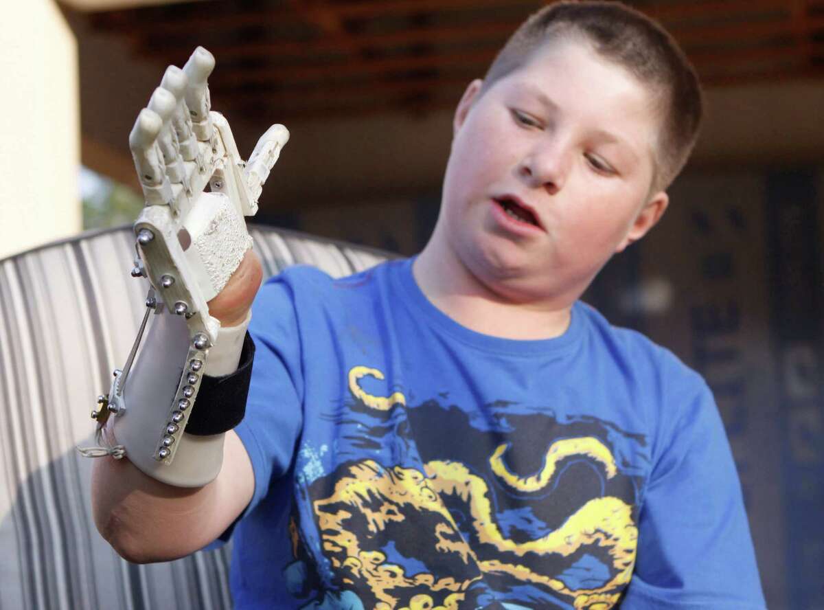 In this photo taken Friday, Aug. 23, 2013 Dylan Laas shows how his Robohand works during an interview with the Associated Press in Johannesburg. Laas who was born with Amniotic Band Syndrome, got his hand from carpenter, Richard van As who lost four fingers to a circular saw two years ago and started workin on building the Robohand after seeing a video posted online of a mechanical hand made for a costume in a theater production. Since then van As has fitted Robohands on about 170 people, from toddlers to adults.