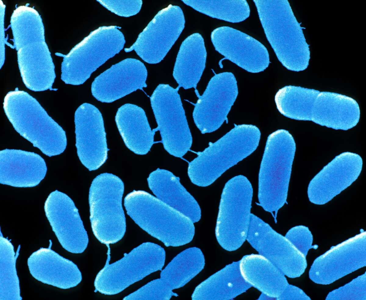 Listeria monocytogenes что это