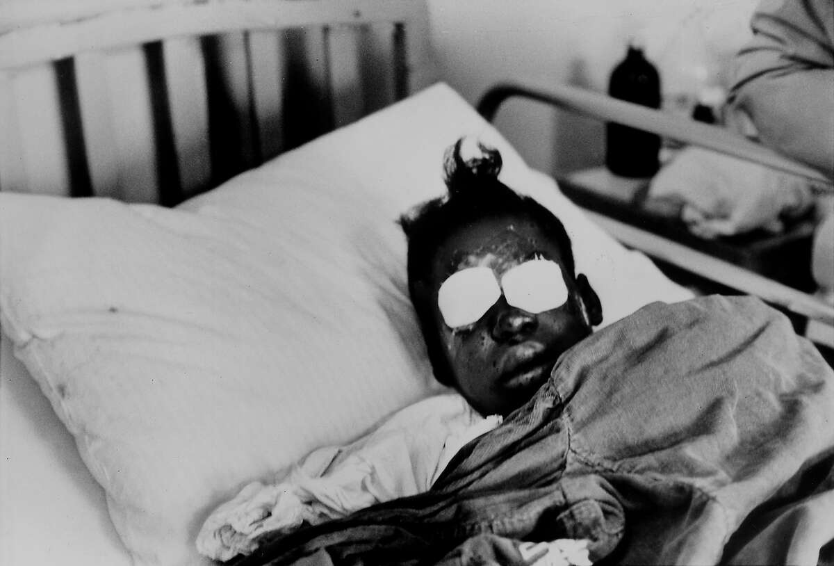 Hospitalized bomb blast victim Sarah Jean Collins, 12, blinded by dynamite explosion set off in basement of church that killed her sister and three other girls as her Sunday school class was ending in Birmingham, Alabama in 1963.