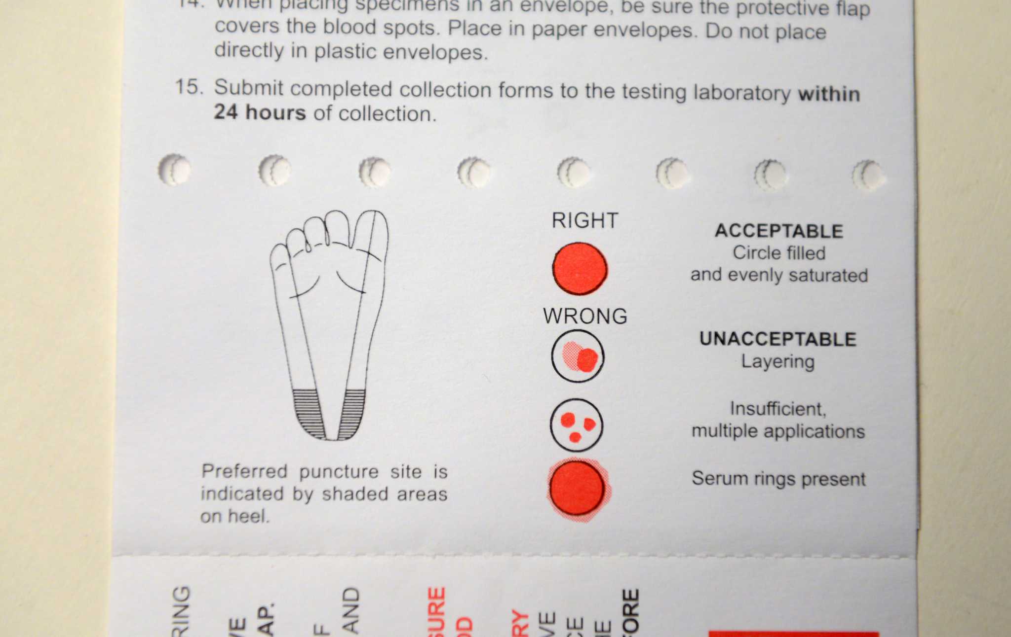 Infant test delays risky