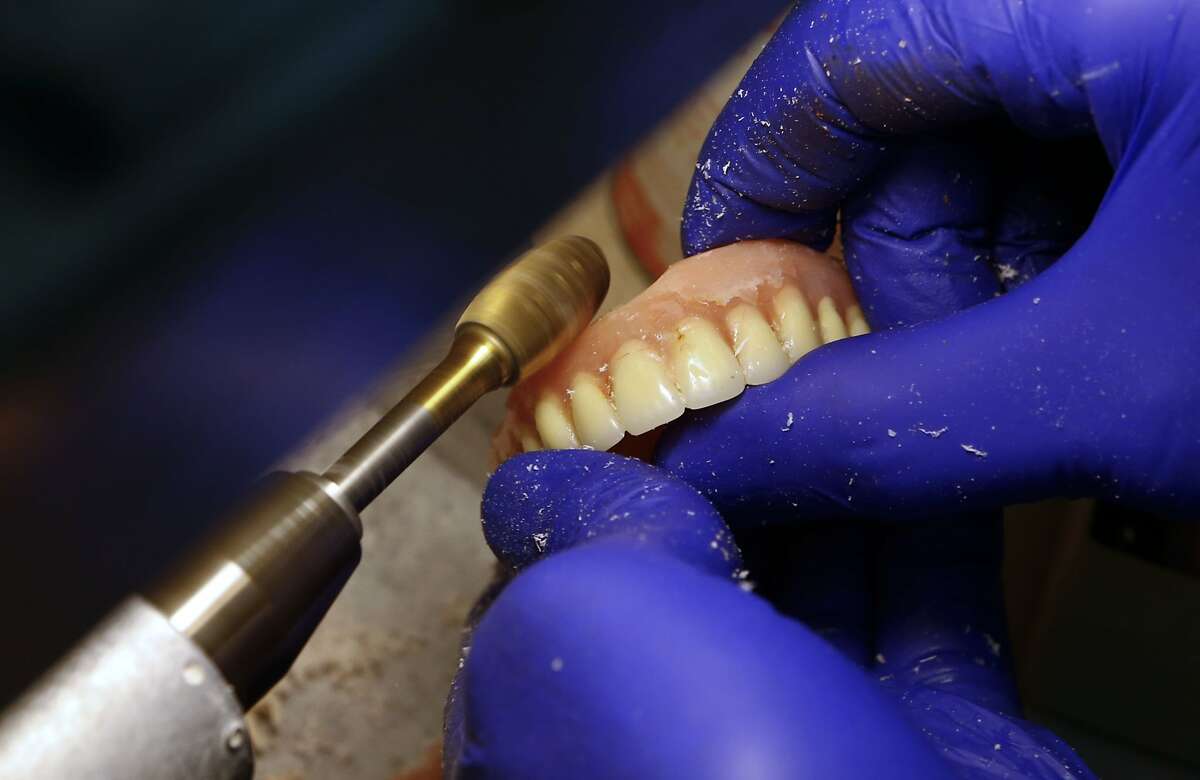 Dr. Walter Tickner grinds and polishes the new denture at his office in San Leandro, Calif. on Wednesday Feb. 12, 2014. Dr. Tickner is using a new denture system where he can fit a patient with a new denture in about an hour saving time and money compared with the present wait of about three weeks.