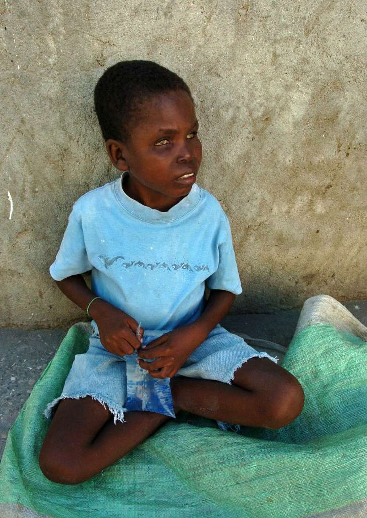 Everyday this little blind boy, sits on a plastic tablecloth leaning against a wall and stares aimlessly at the road as hundreds of people pass him climbing the hill on their way to the Justinien Hospital in Cap-Haitien. He looks to be about six years old but a nearby woman claims he is 11. The plate in front of him is empty of donations.