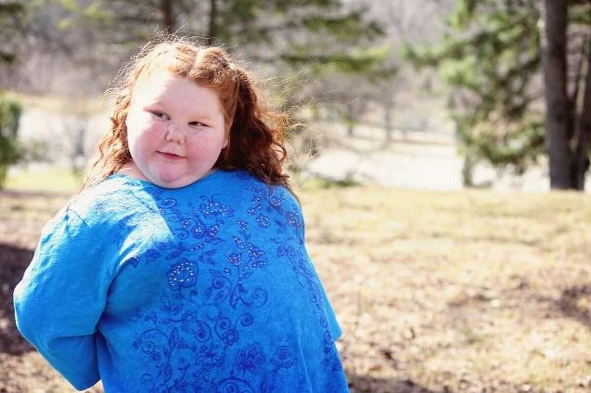 Texas girl has surgery to stop rapid weight gain due to rare medical ...