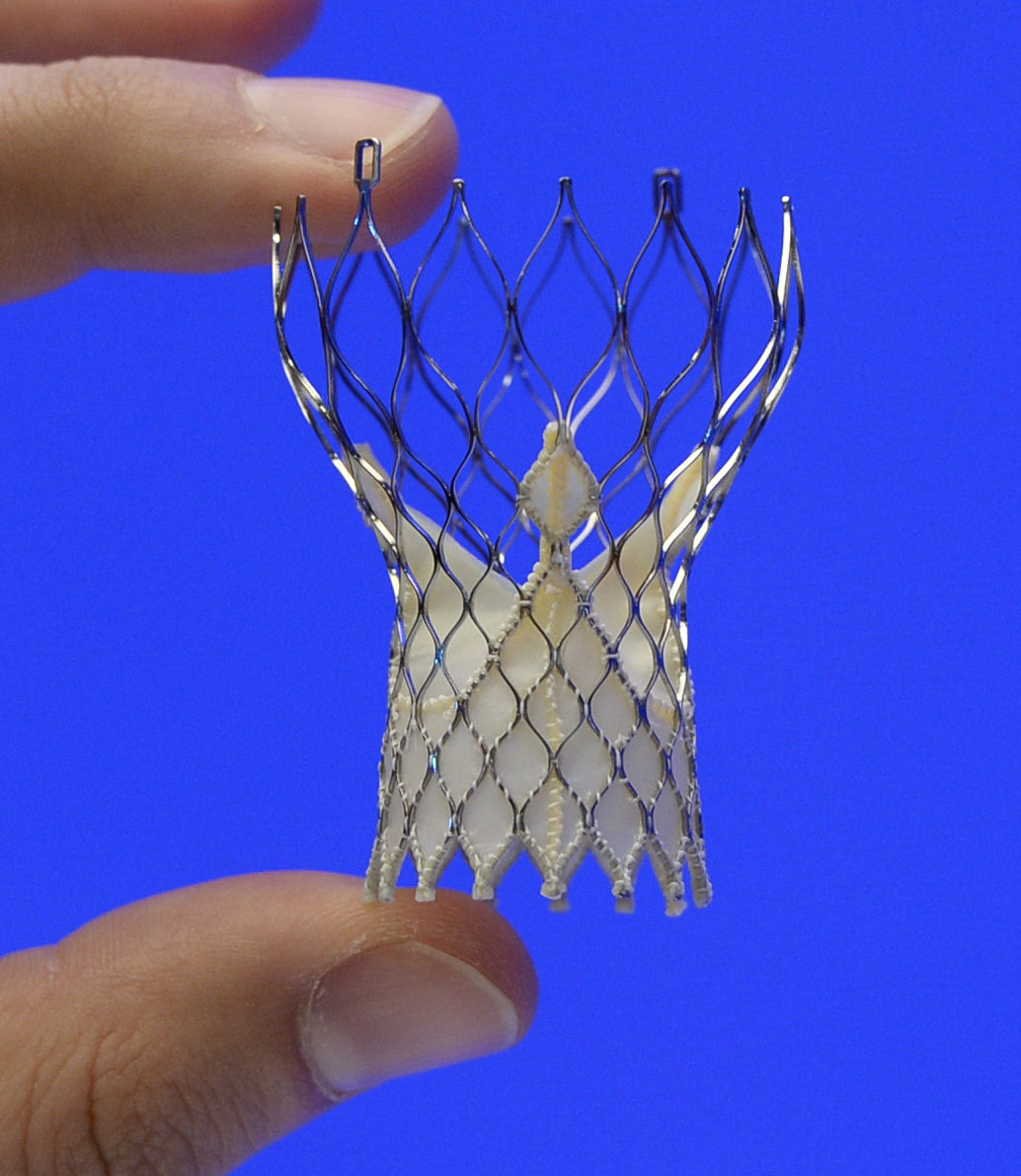 Study backs nonsurgical way to fix heart valves