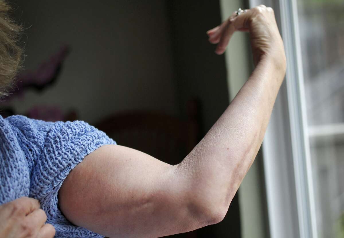 Doctor Develops Simple Treatment For Flesh eating Disease