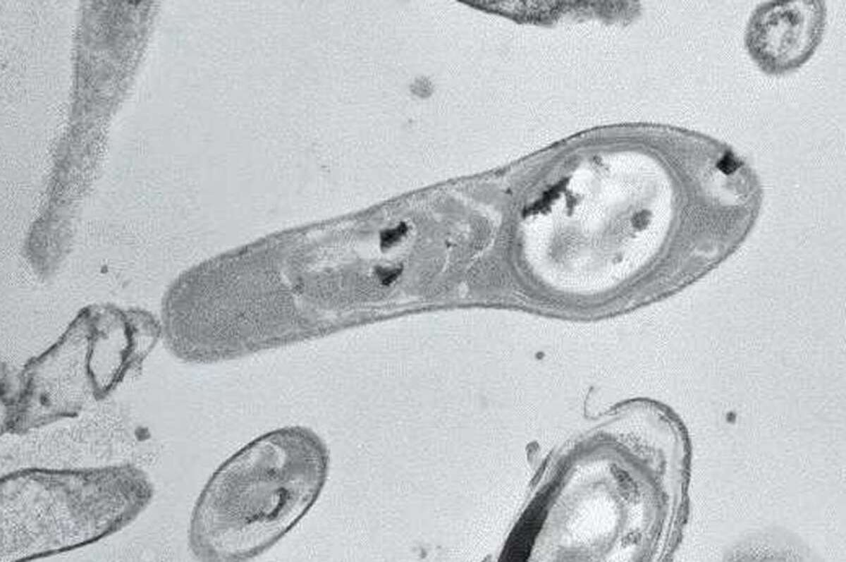 Woman contracts flesheating bacteria in Galveston