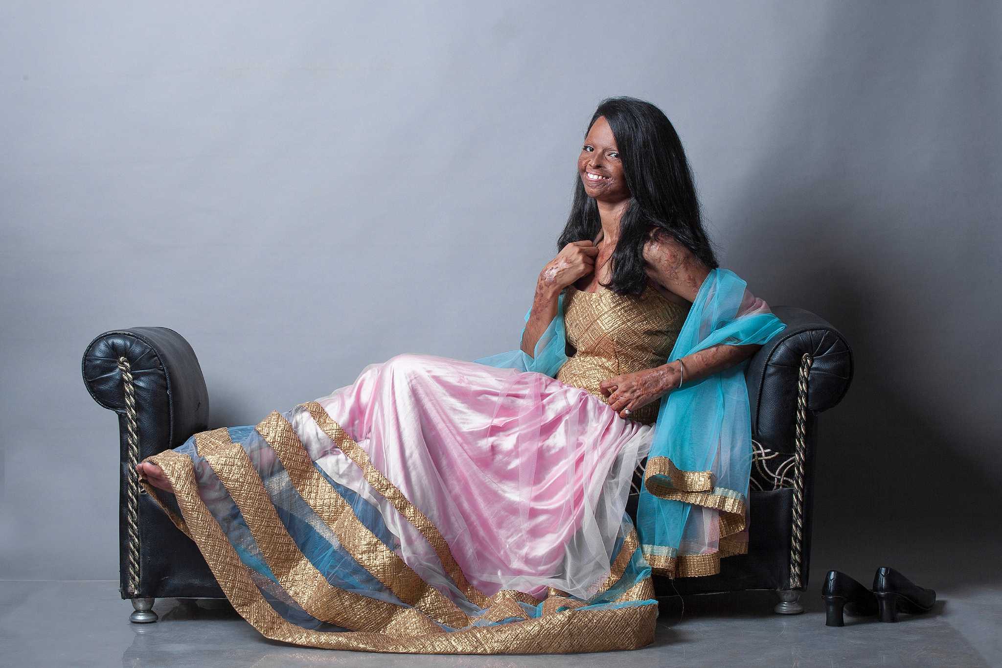 Acid Victims Photo Shoot Draws Attention In India 