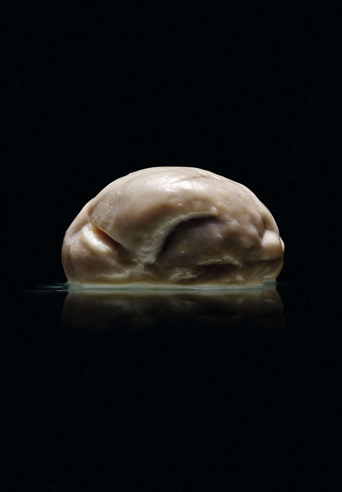 "Malformed: Forgotten Brains of the Texas State Mental Hospital" — authored by Austin photographer Adam Voorhes and journalist Alex Hannaford — shows dozens of photographs of brains of former patients treated at the State Lunatic Asylum, now the Austin State Hospital, from 1952 to 1983. Voorhes said he and Robin Finlay, Voorhes' wife and business partner, discovered the collection — preserved in formaldehyde in several glass containers — at the University of Texas at Austin while on assignment to photograph a different brain in 2011. Pictured, a brain from the collection.