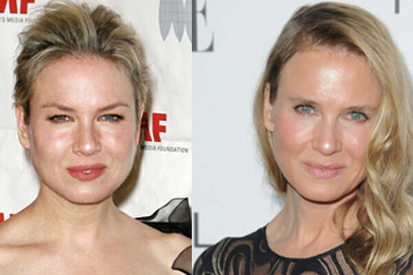 Renee Zellweger, her face and the real world - HoustonChronicle.com