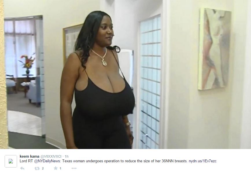 Hope for Nigeria Texas woman gets breast reduction from '36NNN' to