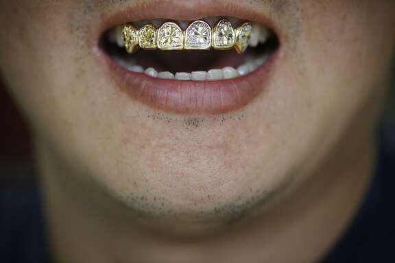 David "Mr. Bling Bling" Moon shows off his own custom grill at his gold teeth shop of 15 years in San Francisco, Calif. All of his work is custom and he often uses his own teeth to in order to help customer visualize the own designs.