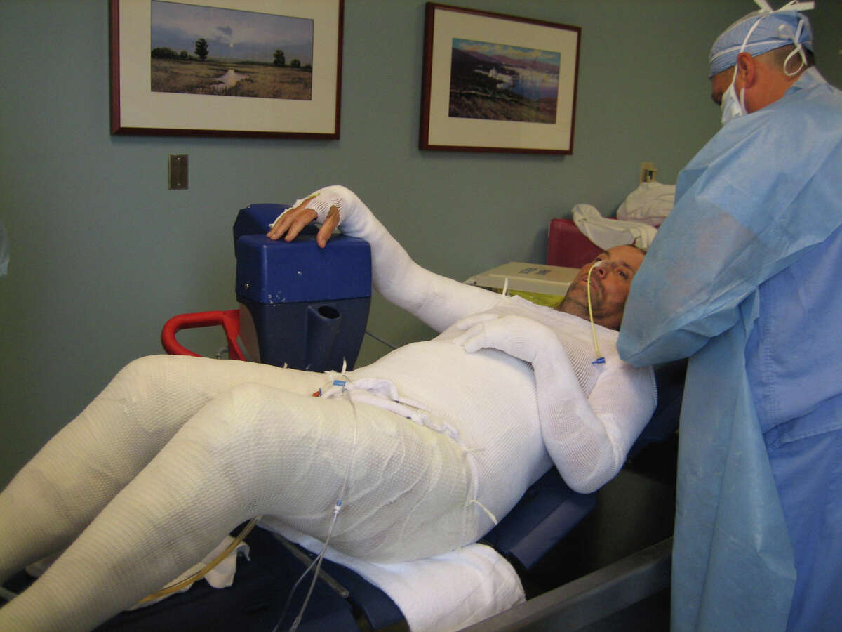 Full Body Plaster Cast