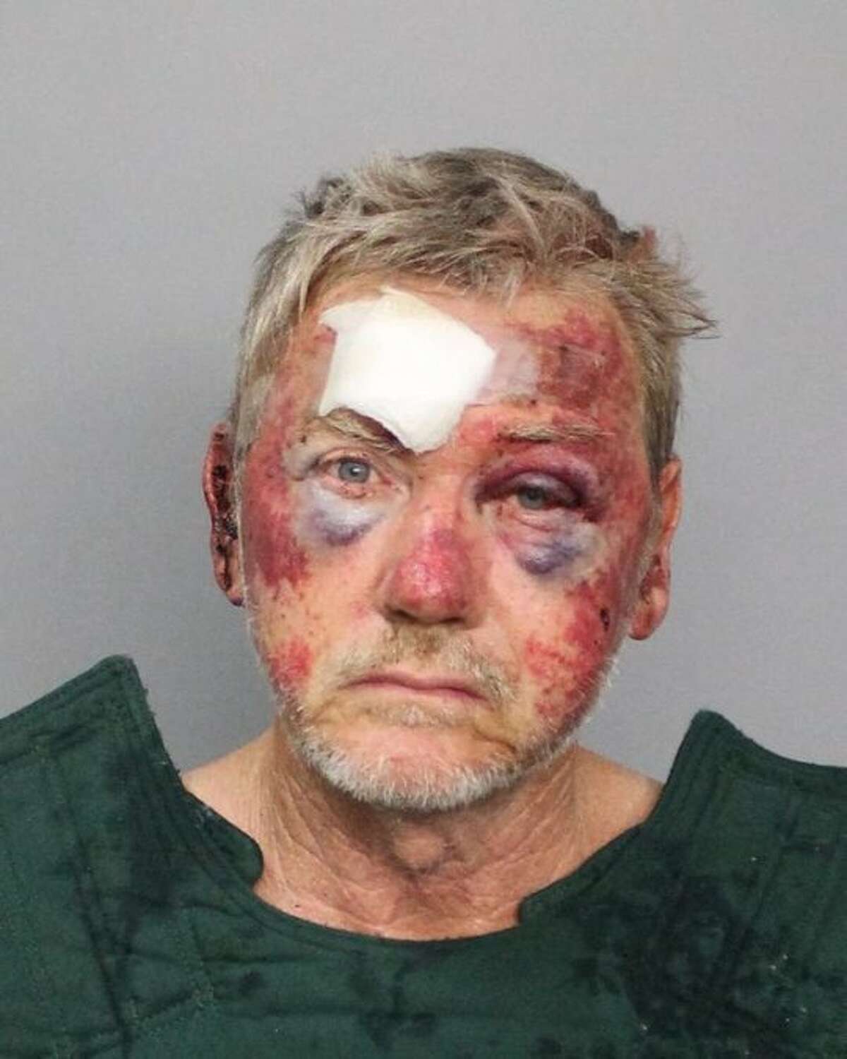 Two Texas officers disciplined for excessive force on 63-year-old