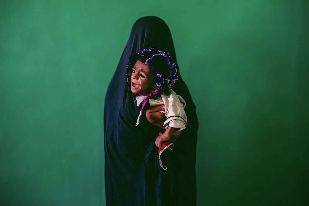 Afghanistan has one of the highest infant mortality rates in the world. ﻿