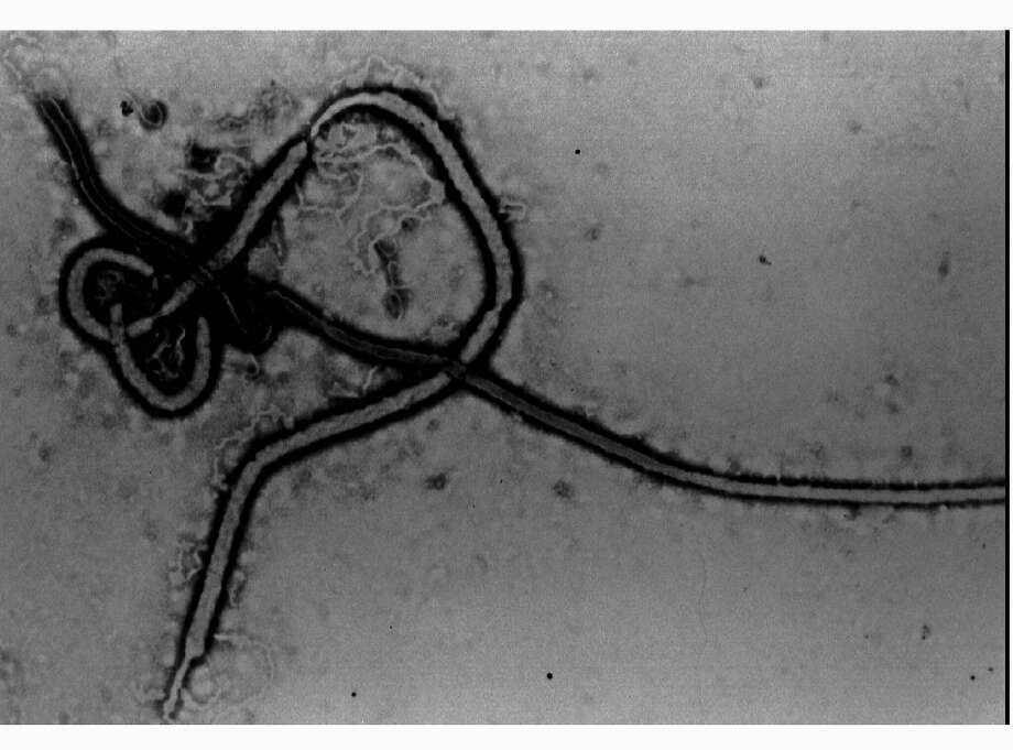 UC Davis hospital in Sacramento treating possible Ebola patient