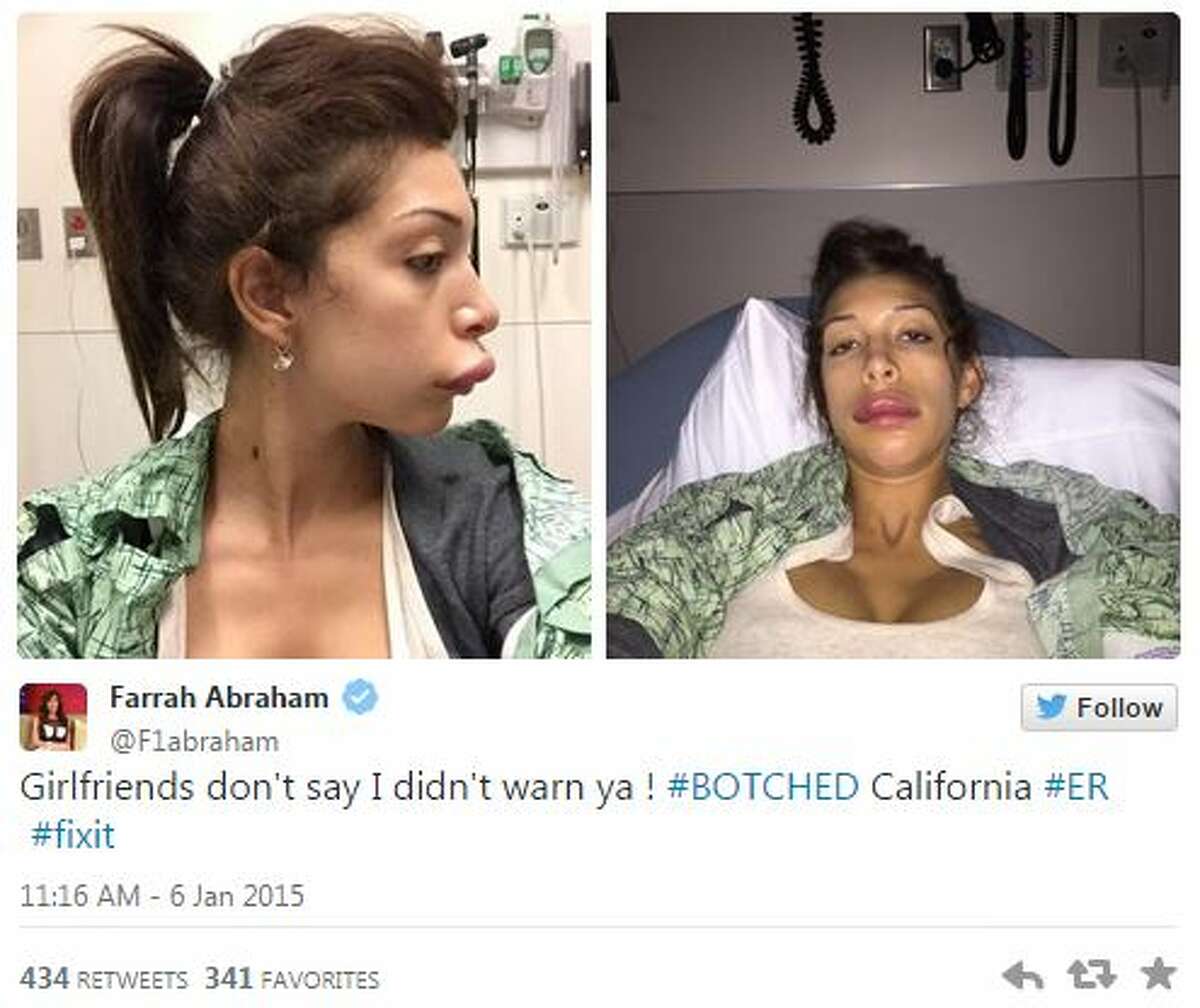 Mom Porn Actresses - Porn star Farrah Abraham's plastic surgery goes terribly wrong, she owns it