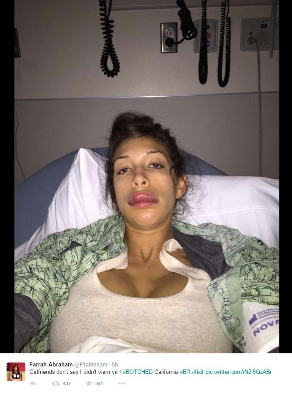 Porn Star Farrah Abrahams Plastic Surgery Goes Terribly Wrong She Owns It 